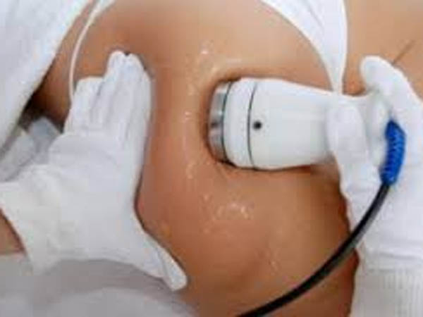 Kavitaciaj je tretman kože primenom ultrazvučnih talasa